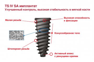 Имплантаты TS IV SA