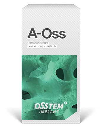 A-Oss