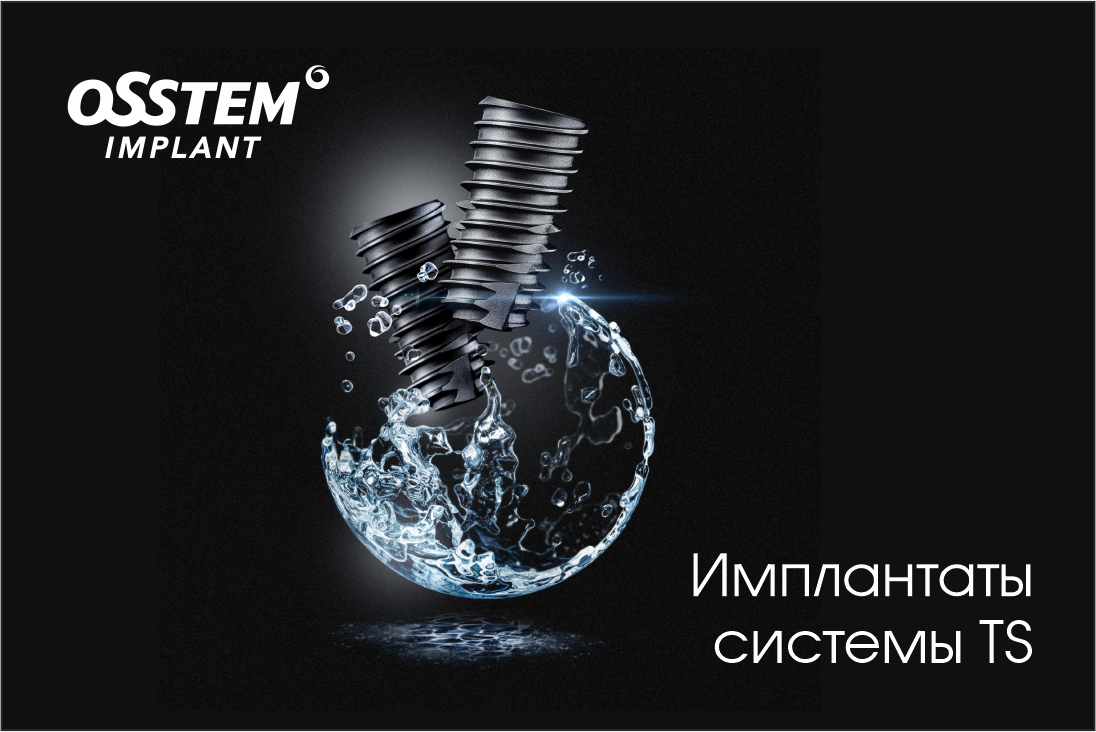 Имплантаты системы TS