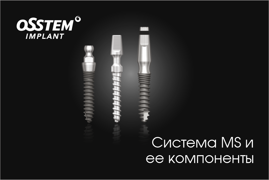 Система MS и компоненты